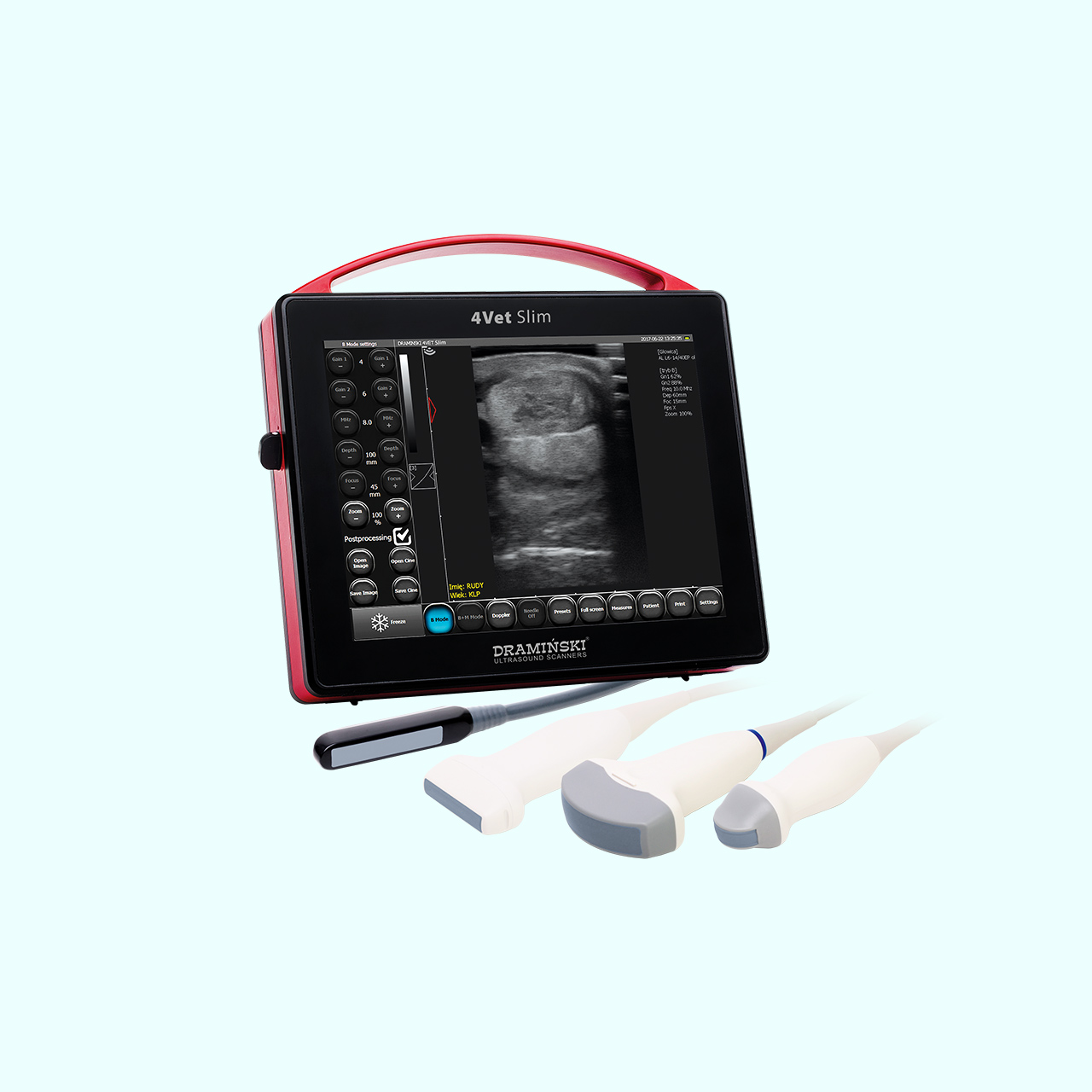 Portable Ultrasound Machines