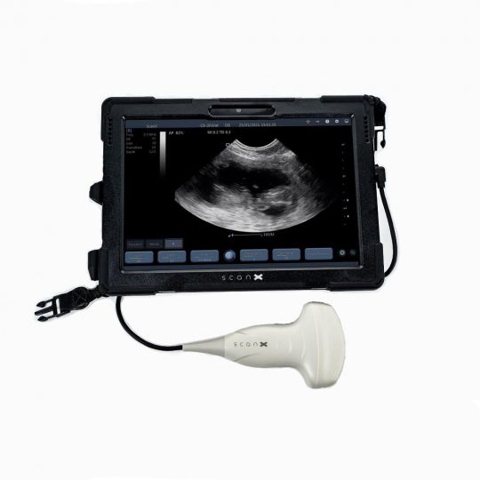 Tablette ScanX 8GB avec option sonde