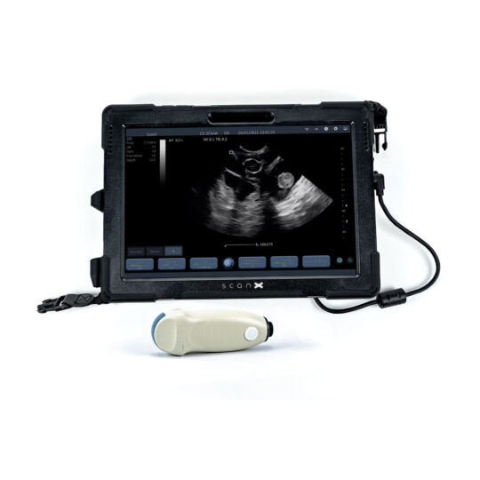 ScanX 8GB Tablet with Probe Option