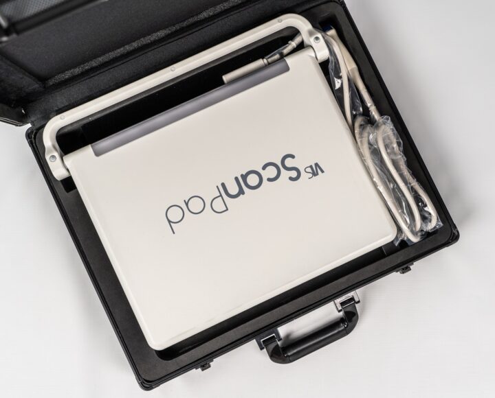 ScanPad Plus Ultrason avec sonde micro-convexe